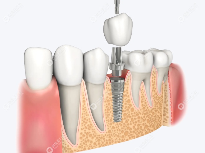 天津宝坻东方口腔门诊部高建岭