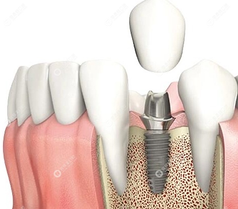 龍巖上杭臨城金億口腔診所章敬