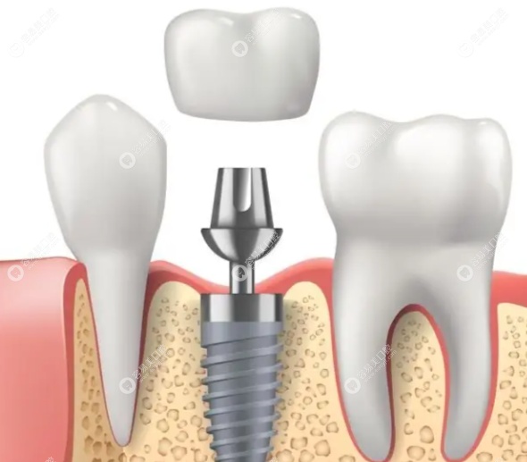 张凯胜医生服务态度