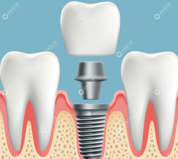 背景与技术优势