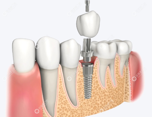 深耕种植领域，专攻疑难病例