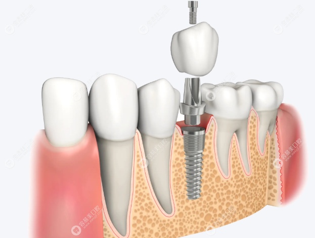 台江美可普口腔门诊部叶卿