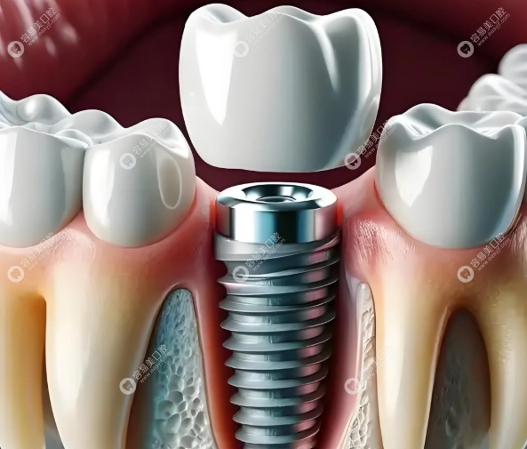 个性化美学修复