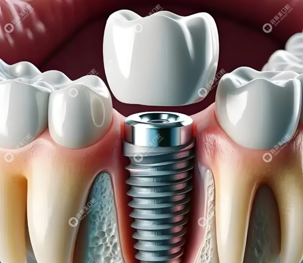 庄晓东擅长项目