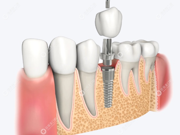 福州美可普口腔群升分院叶益军