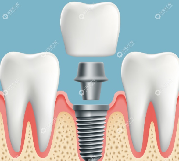 福州美可普口腔东街分院陈文