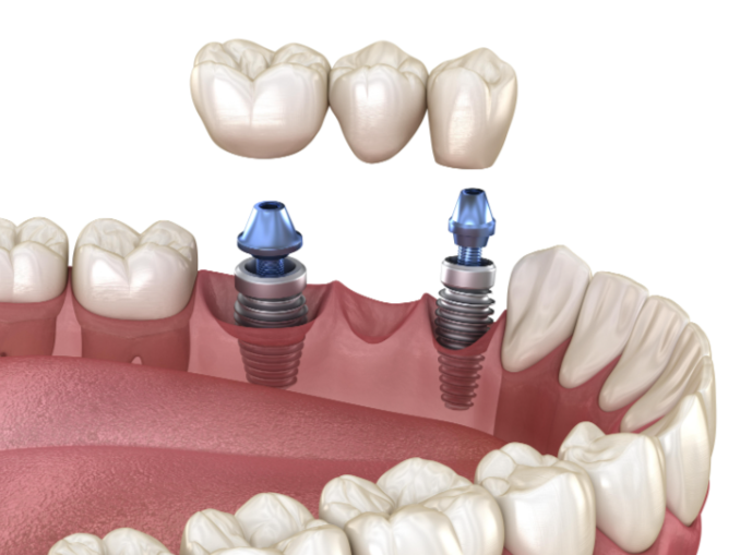 成都新桥口腔行勇军预约挂号指南 流程与注意事项