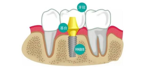 三、北京精德口腔门诊部患者关心的问题：价格、口碑与预约www.easyjf.com