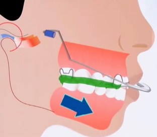 西安优牙口腔营业时间查询攻略，在线询问、电话了解等方法揭秘