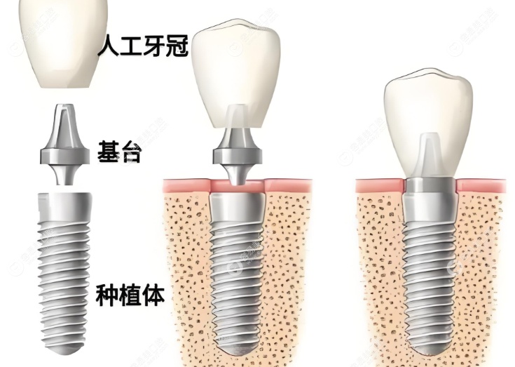 盘州雅唯口腔门诊部谢圣杰