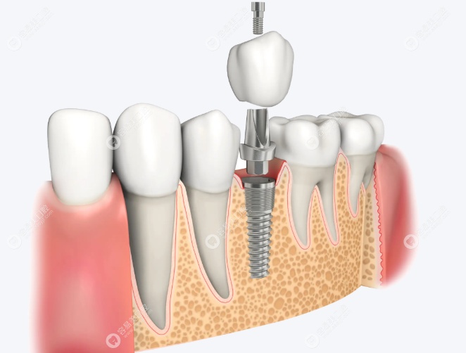 宝鸡高新医院口腔科毛明