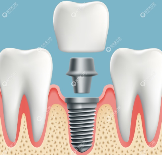 技术特色鲜明,注重细节品质 技术特色鲜明,注重细节品质