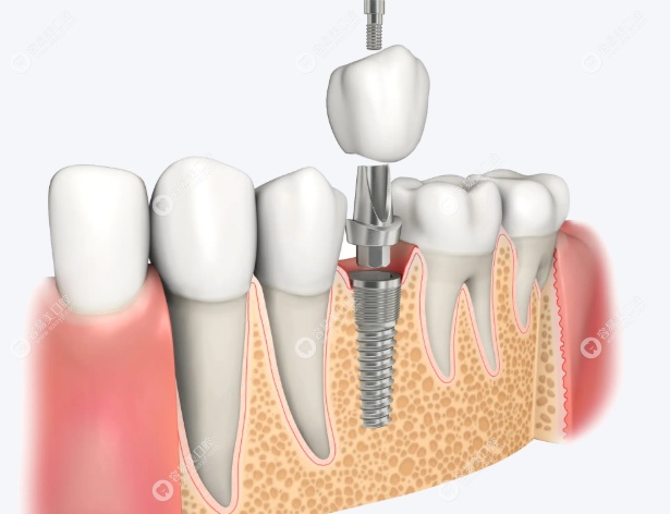 人文关怀温暖,患者口碑载道 人文关怀温暖,患者口碑载道