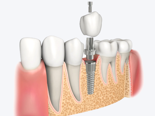 西安海蓓口腔位置在哪里？地址在西安市丈八一路6号含地铁及公交路线