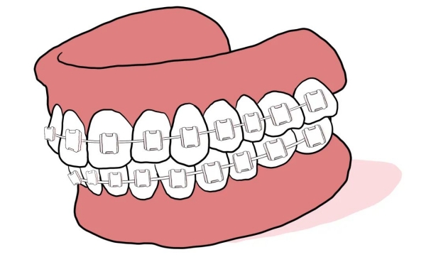 二、深圳弘恩口腔牙齿矫正项目优势