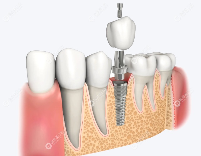 劉長(zhǎng)欽技術(shù)理念