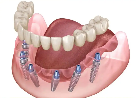 三、特色项目：满足多元需求的专门服务www.easyjf.com