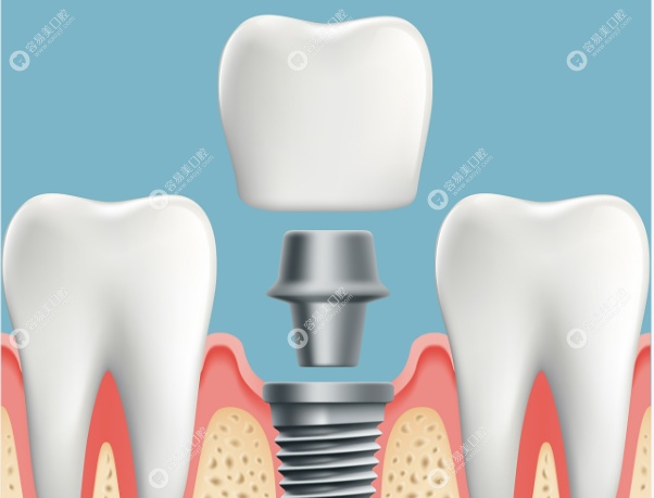 陈宏军擅长项目