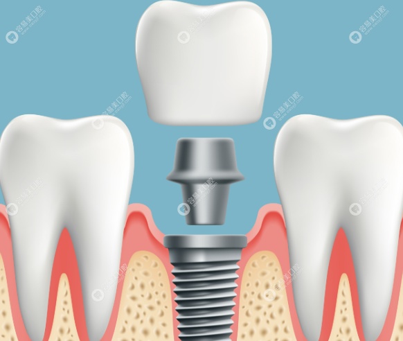 宿迁中喜口腔诊所高超
