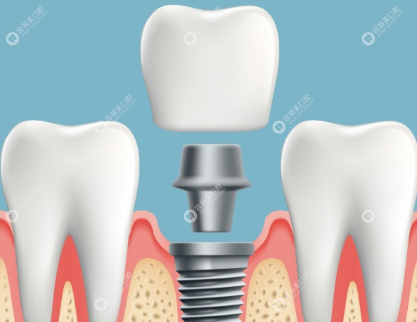 临床专长：以种植修复为核心的多维技术体系