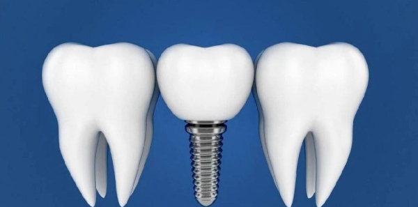 双流本地人推荐一牙桔子的原因:口碑里藏着真实体验