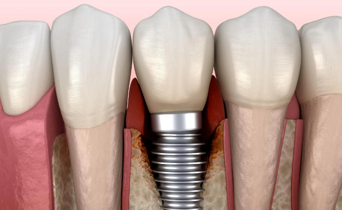 从江雅卫士口腔在从江哪个地方？丙梅街道北上新区瑞金花园D区2号楼地上一层、二层
