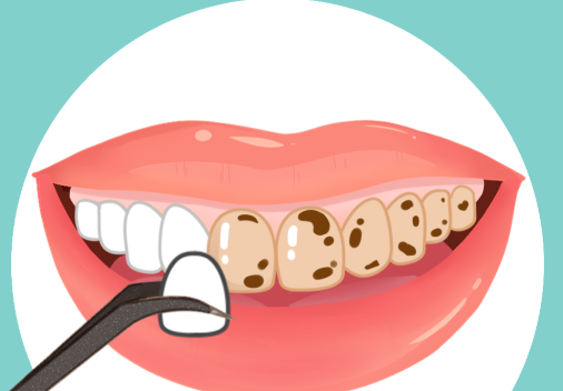 资中牙米口腔门诊部靠谱性验证：2024年当地口碑前3的核心依据