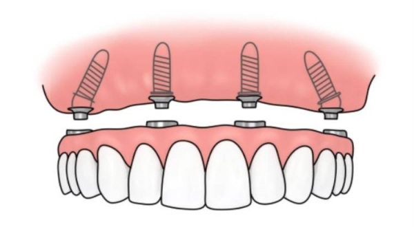  从江雅卫士口腔几点上班？营业时间周一至周日08:30-18:00，让你看牙不扑空