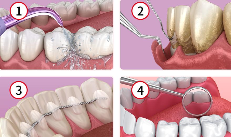 扬州牙科王晶晶医生个人简介揭秘：精细牙周治疗实力派，安心选择