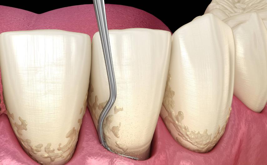 扬州牙科王晶晶医生个人简介揭秘：精细牙周治疗实力派，安心选择