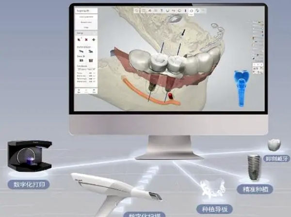 2026南京建邺泰康口腔种植牙价格大揭秘！登腾2980元起真划算，放心冲