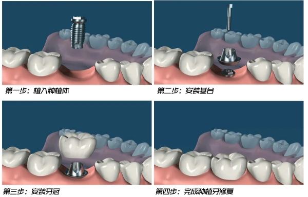南通玉蕙口腔地址在哪？一文带你了解机构实力及门诊部具体位置