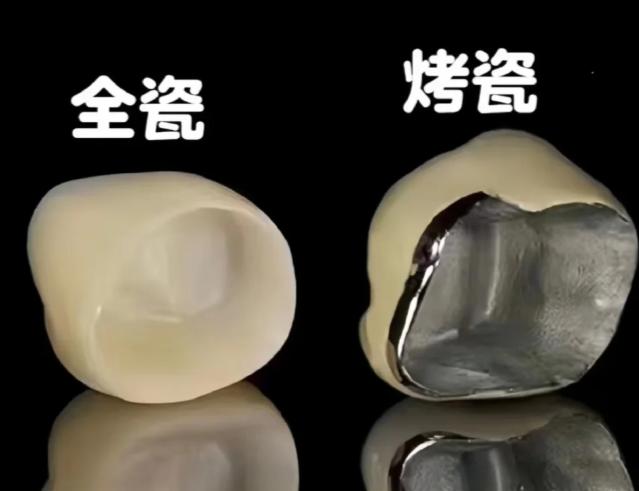 2026南通烤瓷牙价格表大揭秘，钛合金500元起，普通烤瓷牙200起