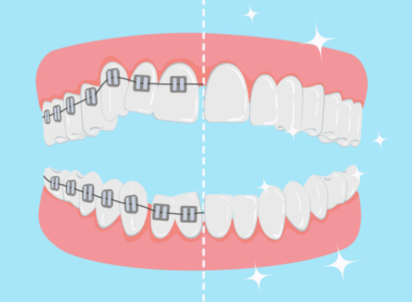 宝鸡友谊口腔贾万杰医生怎么样？靠谱牙医+正畸项目精细诊疗获好评