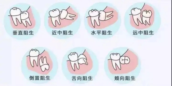 宝鸡小丁口腔能拔智齿吗？正规资质+拔牙项目，实力揭秘