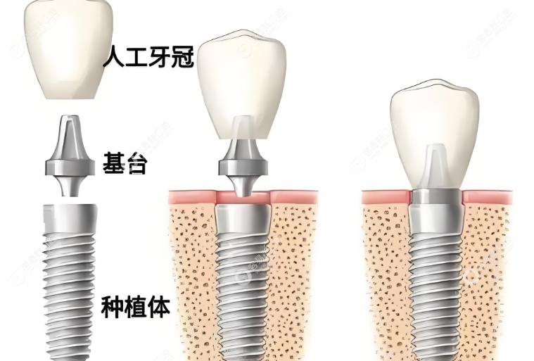 哈尔滨优齿美口腔项目