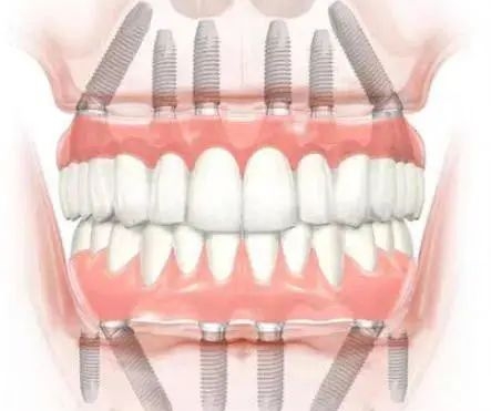 徐州品名口腔地址公开：在黄山大道保利鑫城，护牙之旅安心开启