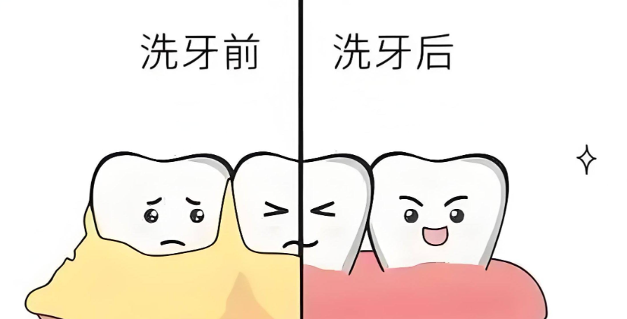 徐州美奥口腔洗牙效果好吗？个性化服务提升洗牙体验，价格100元起