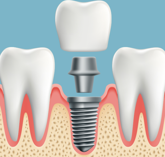 想约宿迁中喜口腔医院24小时人工服务？这三种预约途径别错过