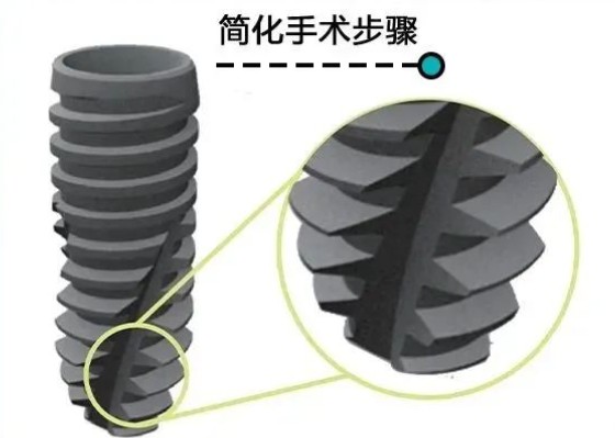 宿迁博尔口腔和博胜口腔哪个好？看完这6点对比不再纠结选哪家！