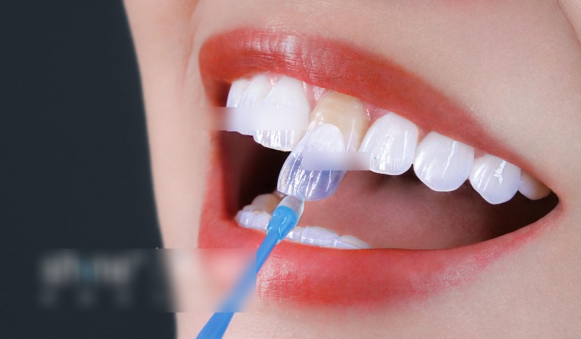 2026益阳牙科哪个医院好？排名前十牙科有益阳伢尔舒口腔，上榜不仅是因为正规