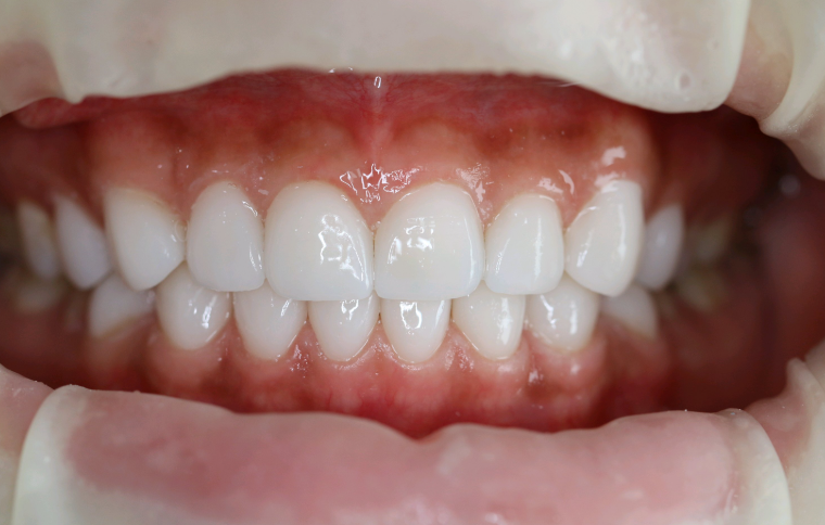 8. 方帅鑫（上海宏康医院口腔科专科医生）