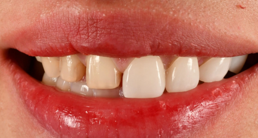 9. 廖雅婷（永州中南口腔医院执业医师）www.easyjf.com