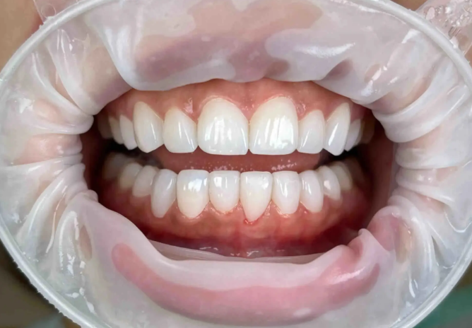 5. 奥玛（全口无牙颌修复医生）