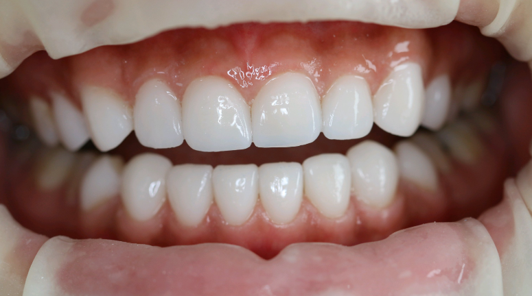 7. 李梦思（北京维乐口腔门诊部院长）