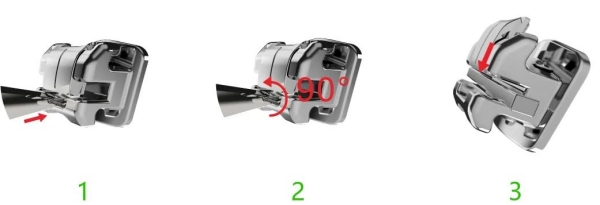   綿陽(yáng)牙齒矯正哪家醫(yī)院好又便宜，推薦綿陽(yáng)5收費(fèi)不坑的正規(guī)牙科醫(yī)院