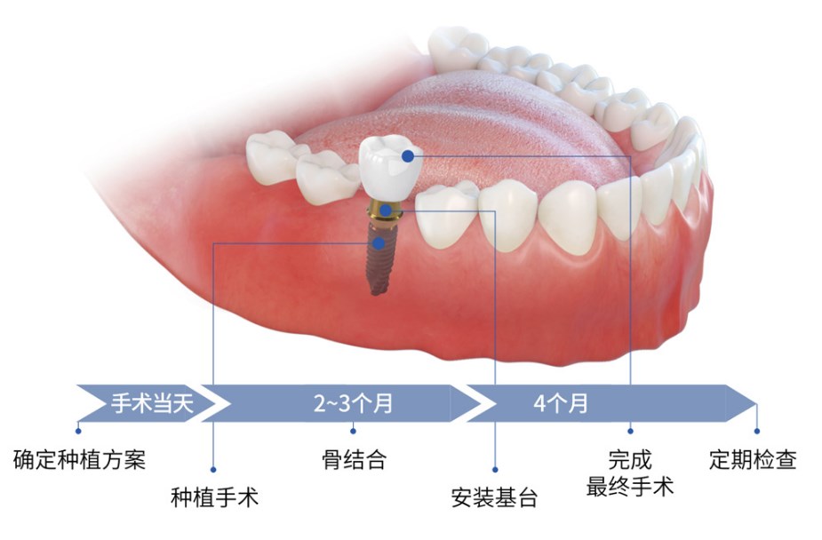 武汉虎泉口腔医院真实评价：正规一级资质，种植牙矫正技