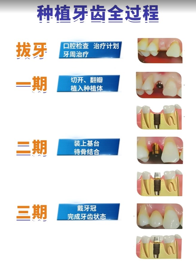 微創(chuàng)美學(xué)種植www.tidaizhe.cn