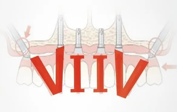立得用種植技術(shù)體系