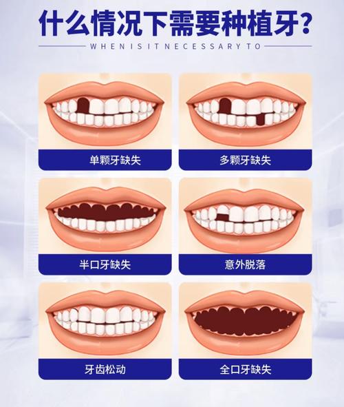 提前预约很重要
